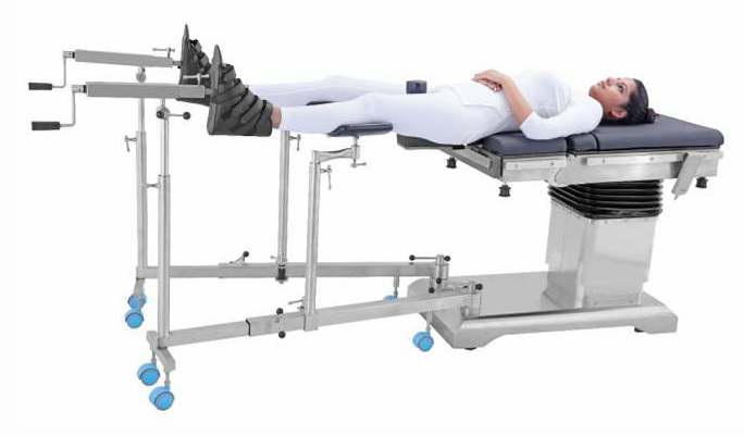 1206 ((ALBEE’S TYPE ORTHO ATTACHMENT)